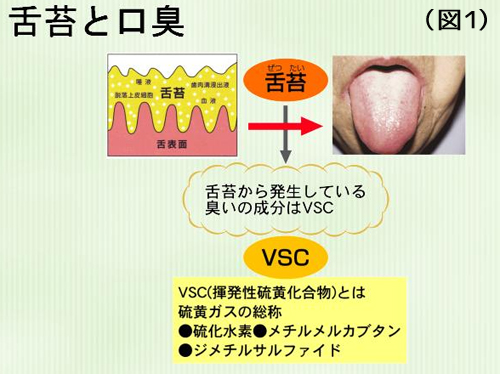 （図1）