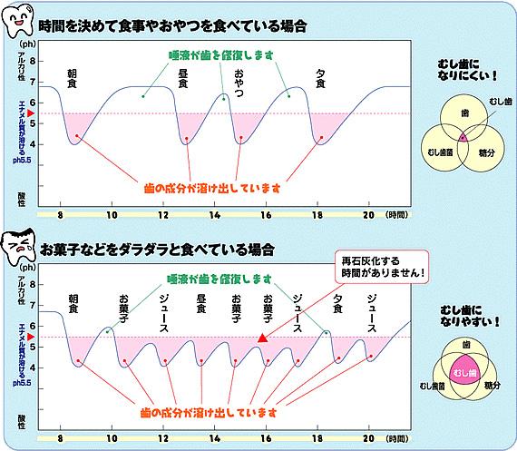 虫歯になるとき