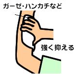 止血の方法