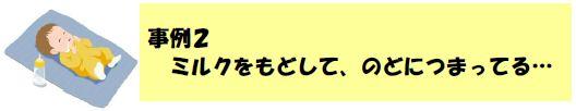 事例２ミルクをもどして、のどにつまってる…