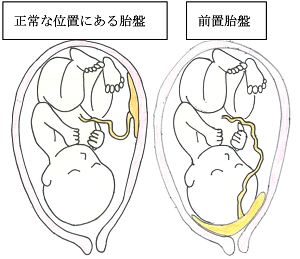 大量の異常な性器出血